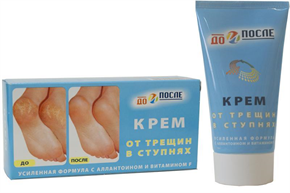 Купить до и после крем от трещин в ступнях 150 мл цена и отзывы
